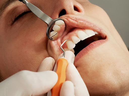 Woman receiving dental treatment at the dentist's office.