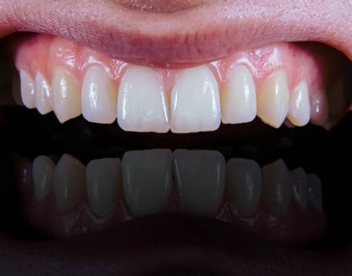 Close-up of a smiling person's mouth showing healthy teeth.