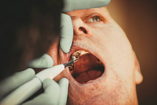 Man receiving a dental checkup from a dentist."